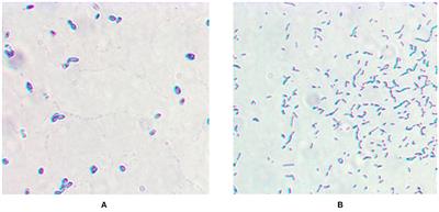 A Comparative Study on the Biodegradation of 17β-Estradiol by Candida utilis CU-2 and Lactobacillus casei LC-1